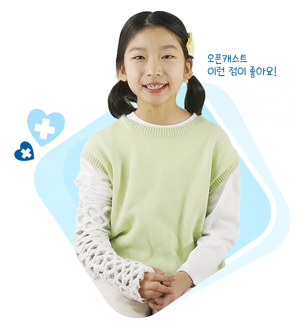 오픈캐스트 기능 이미지