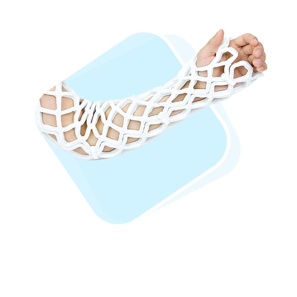 오픈캐스트 제품 옵션