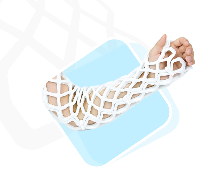 오픈캐스트 제품 옵션